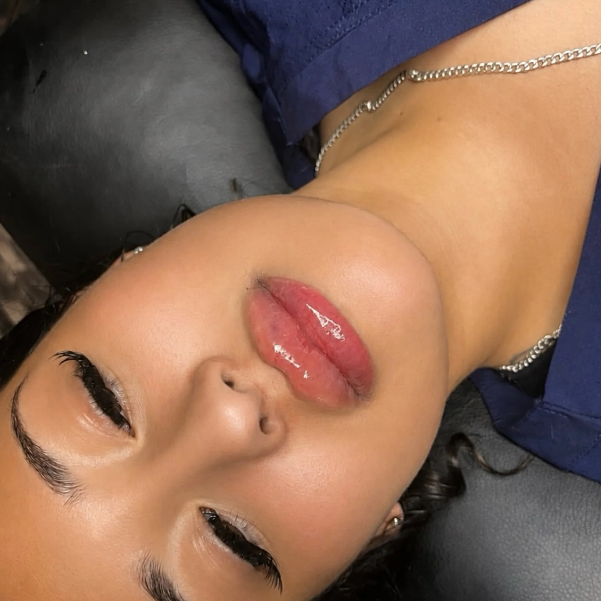 facial aesthetics and filler guidance